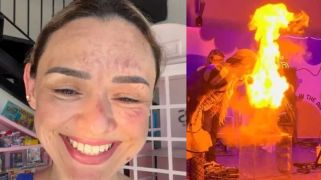 Influencer Arlen Hernández Sufre Quemaduras en el Rostro por un Pastel Explosivo